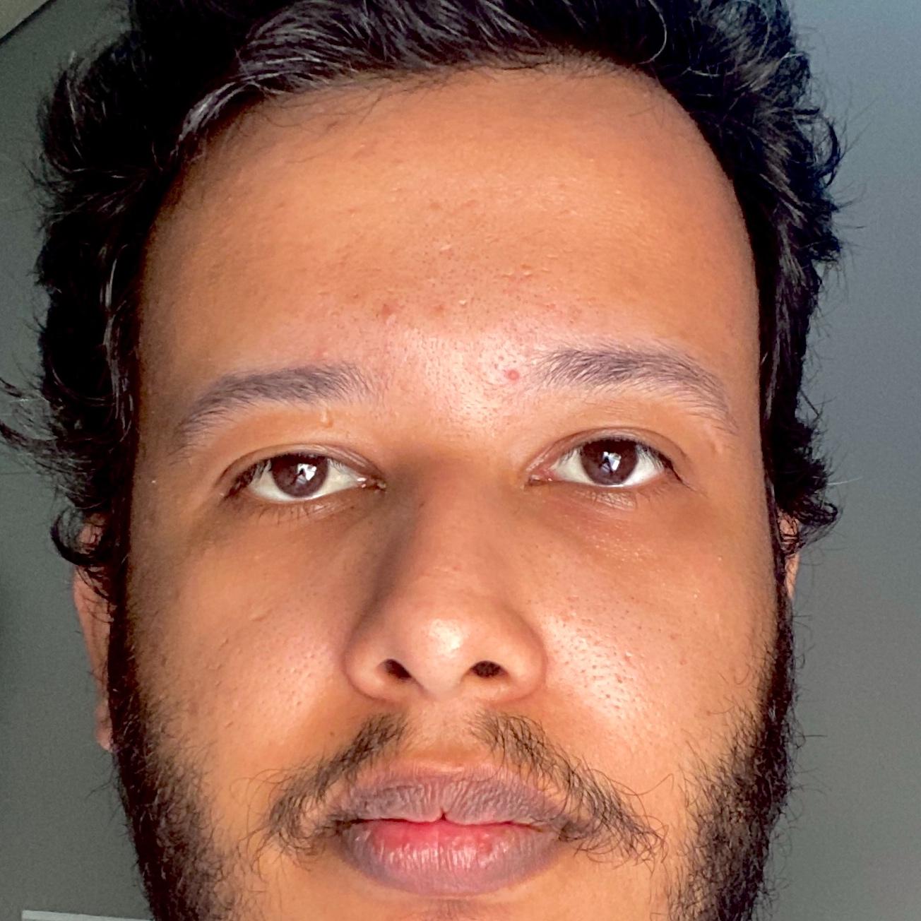 محمد الصعيدي